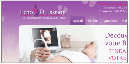 Echographie 3D